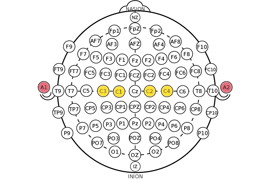 fig2-electrodes-configuration.jpg