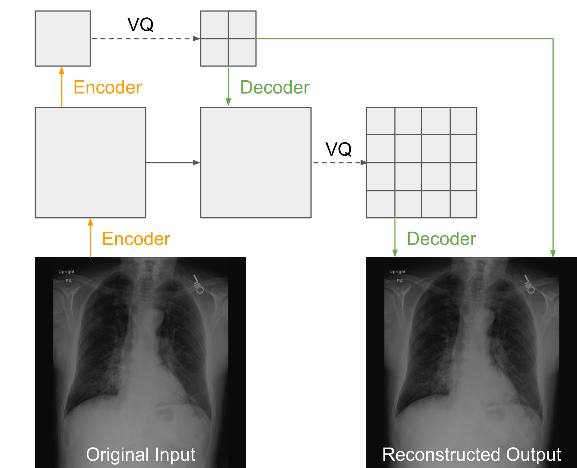 VQ_VAE_Multi-Level_Architecture.png