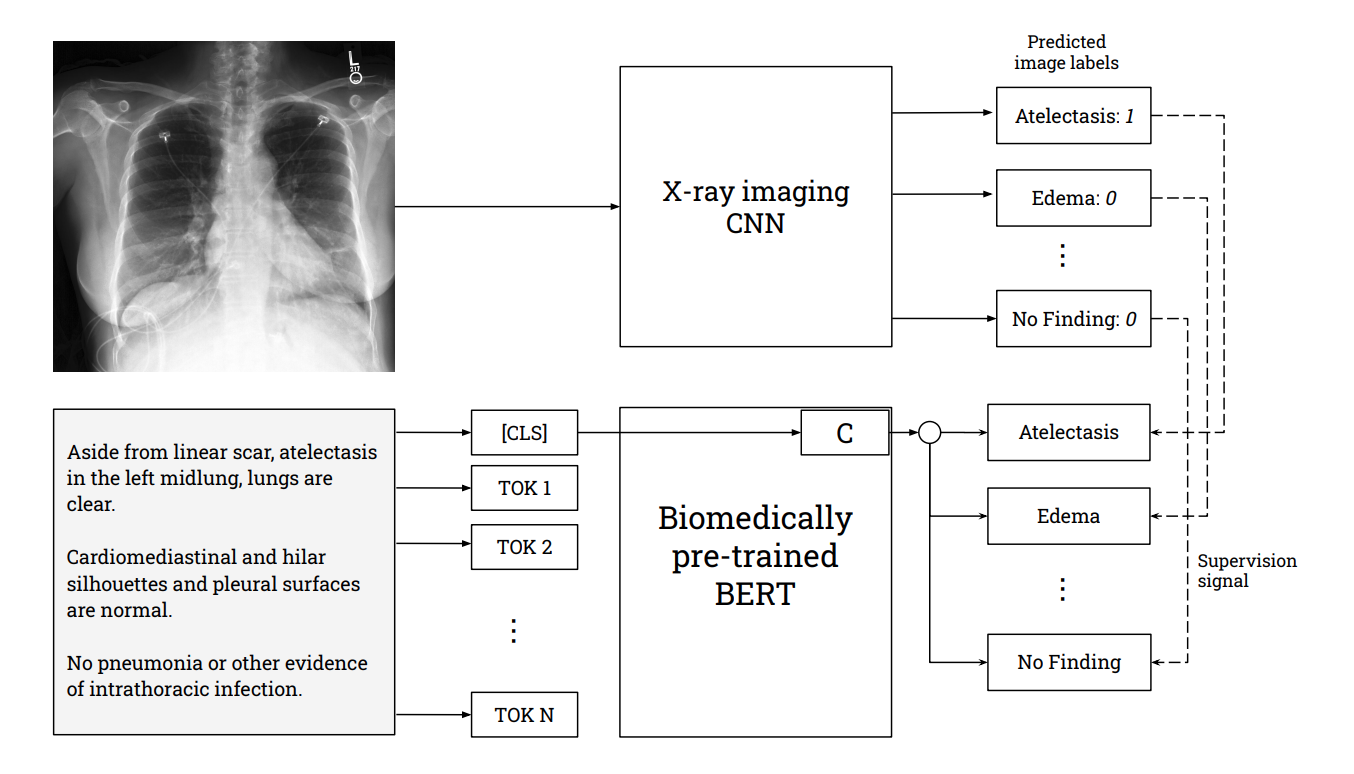 VisualCheXbert_Figure.png